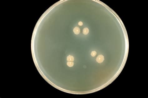 Public Domain Picture This Agar Plate Culture Of The Fungus
