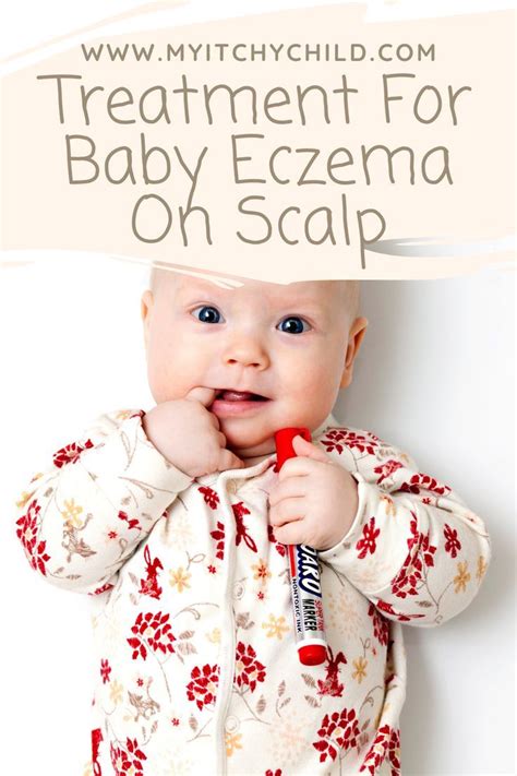 How To Treat Scalp Eczema In Babies My Itchy Child Baby Eczema