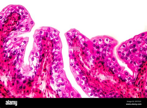 Transitional Epithelium Tissue Of The Urinary Bladder Under Microscope