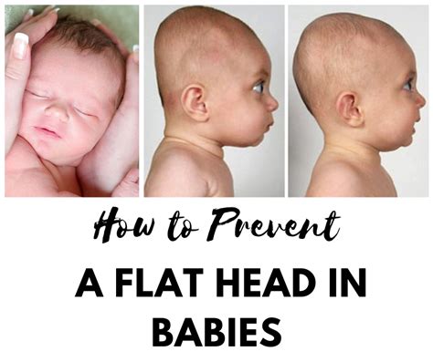 Preventing And Treating Flat Head Syndrome In Babies Be A Positive Mom