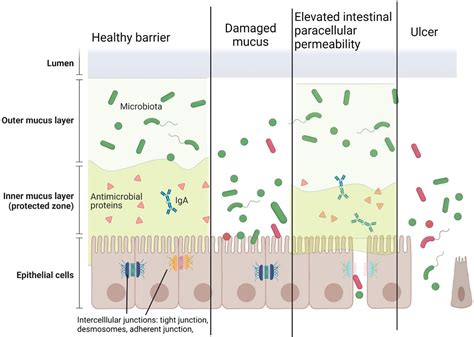 Frontiers The Influence Of Nutrition On Intestinal Permeability And