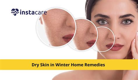 Dry Skin In Winter Home Remedies