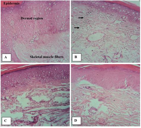 Histopathological Examinations On Carrageenan Induced Edema Paw Tissues