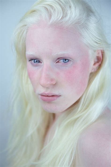Fotos Que Muestran La Belleza De Personas Con Albinismo