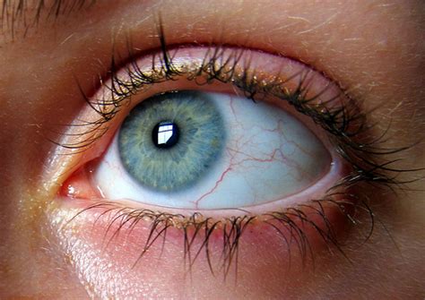 According to allaboutvision.com, a website that provides eye health information, a typical annual premium for a benefits package for an individual. Eylea Injections Cost | HowMuchIsIt.org
