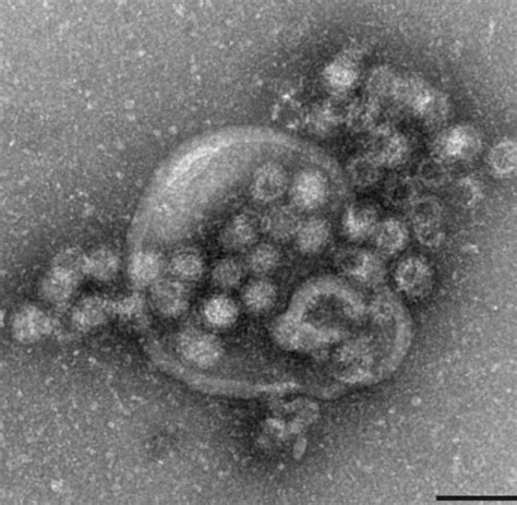 We would like to show you a description here but the site won't allow us. Jugendfreizeit: Norovirus vermutlich Ursache für Krankheit ...