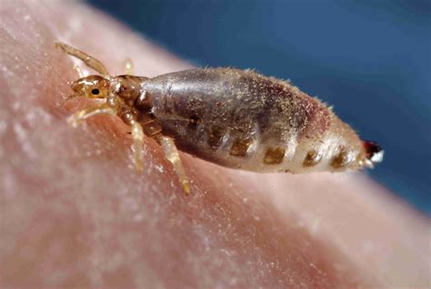 Can Pets Get Head Lice From Kids