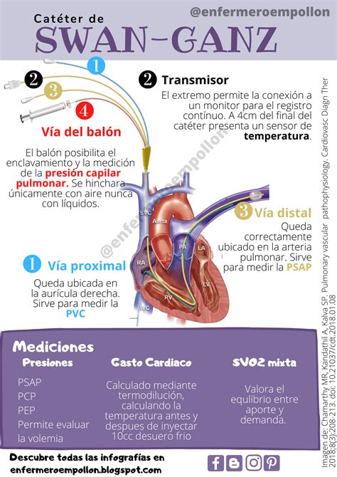 Cateter Swan Ganz Para Que Serve