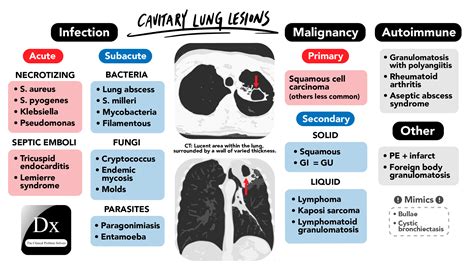 Dx Schema Lung Cavity The Clinical Problem Solvers