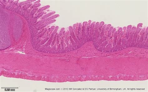 Low magnification micrograph of the ileum illustrating the ...