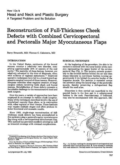 Pdf Reconstruction Of Full Thickness Cheek Defects With Combined