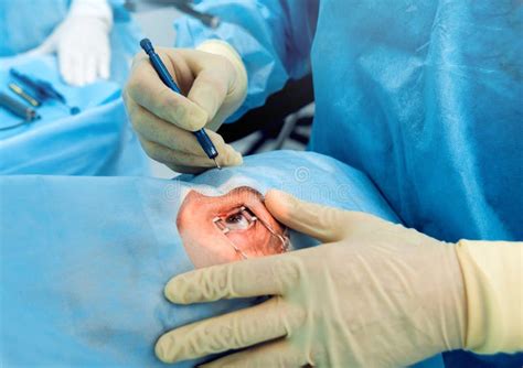 The Operation On The Eye Cataract Surgery Stock Photo Image Of Inside Clinic