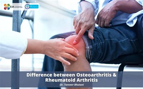 Difference Between Osteoarthritis And Rheumatoid Arthritis