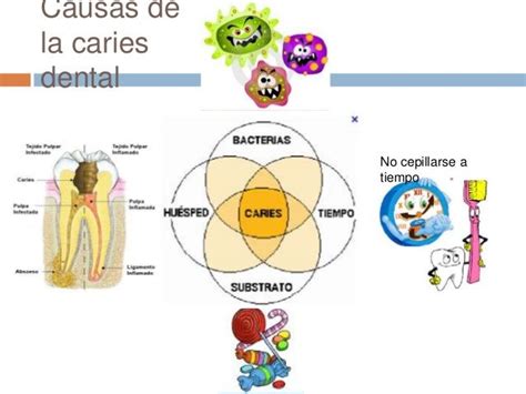 Caries Mind Map