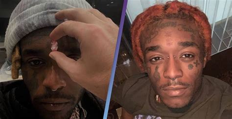 Rapper Lil Uzi Vert Shares Video Of 24 Million Pink Diamond Implanted In His Forehead