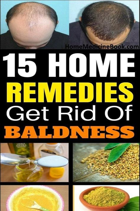 Top Home Remedies To Get Rid Of Baldness Hair Remedies For Growth