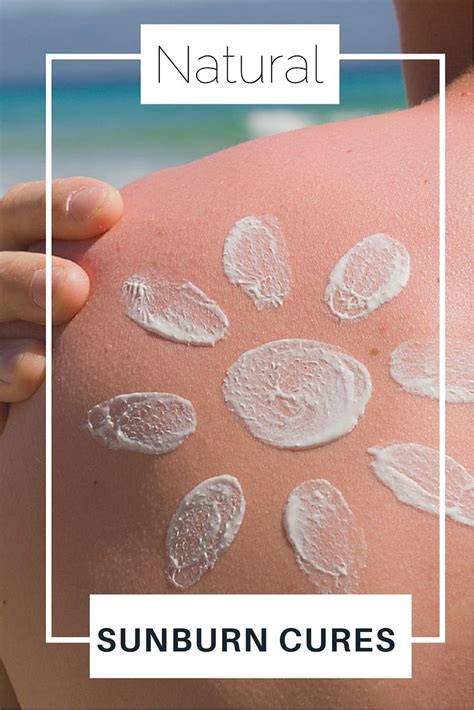 Natural Ways To Relieve A Sunburn That Actually Work Cure For