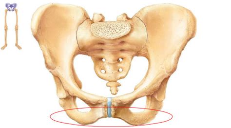Often groin strain occurs in the area of inguinal ligament. Pubic Ramus is a common pain area for sports hernia injuries - Physiqz
