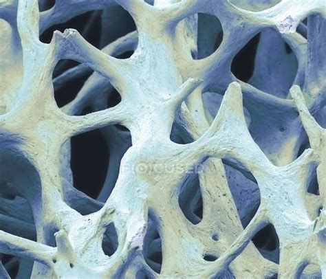 Cancellous Bone Stock Photos Royalty Free Images Focused