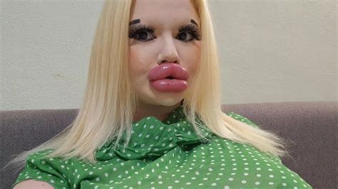 Woman With World S Biggest Lips Can T Find Love Of Her Life Despite Legions Of Fans World