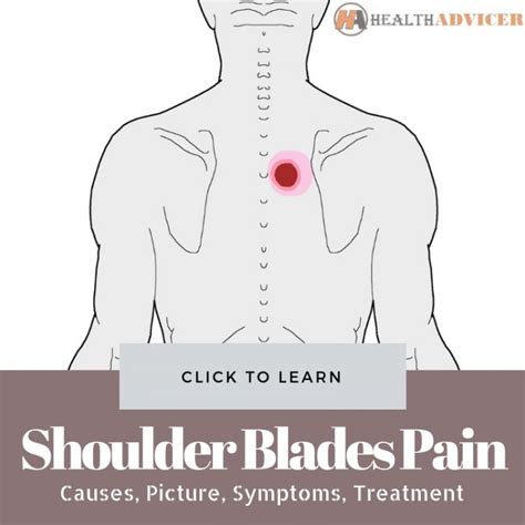 Pain Between Shoulder Blades Symptoms Diagnosis And Treatment