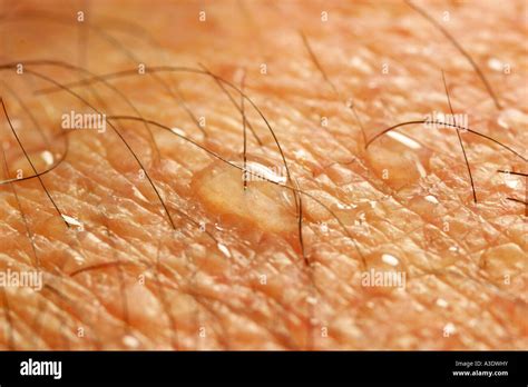 Makro Shot Of The Human Skin With Sweat Hair And Pores Stock Photo