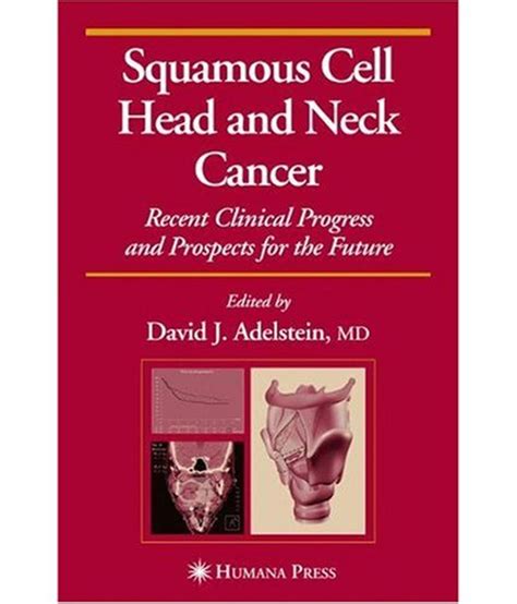 Squamous Cell Head And Neck Cancer Buy Squamous Cell Head And Neck