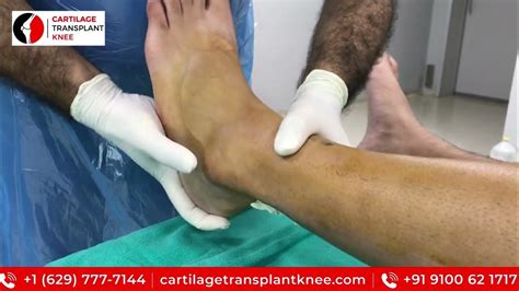 Ankle Surgery Arthroscopic Debridement And Ligament Reconstruction