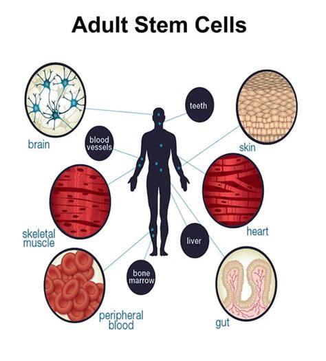Stem Cell Therapy In Mumbai India Neurogen Bsi