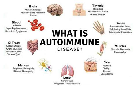 Diseases Of Autoimmune