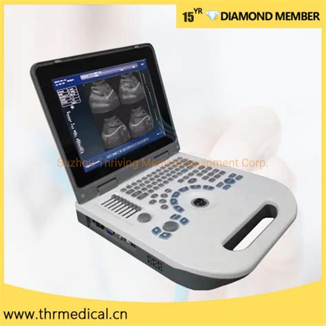 Medical Diagnostic Equipment Laptop Ultrasonido Portable B Ultrasound