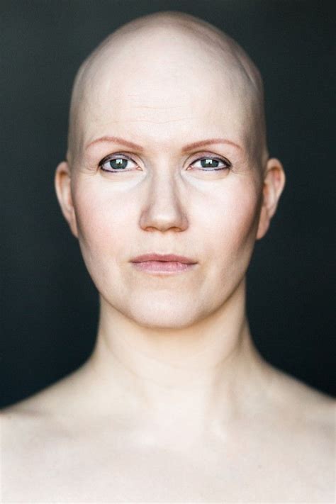 projeto fotográfico quer redefinir conceito de beleza para mulheres carecas normal hair loss