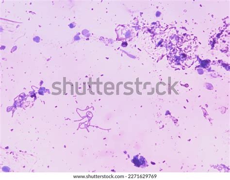 Bacillus Megatherium Microscopic Gram Staining Stock Photo 2271629769