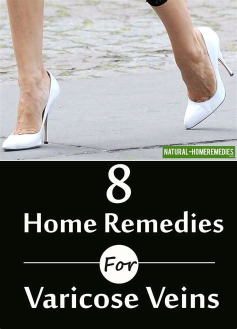 8 Home Remedies For Varicose Veins Natural Home Remedies