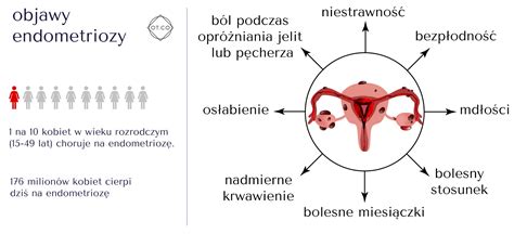 Endometrioza Przyczyny Objawy Leczenie Endometriozy