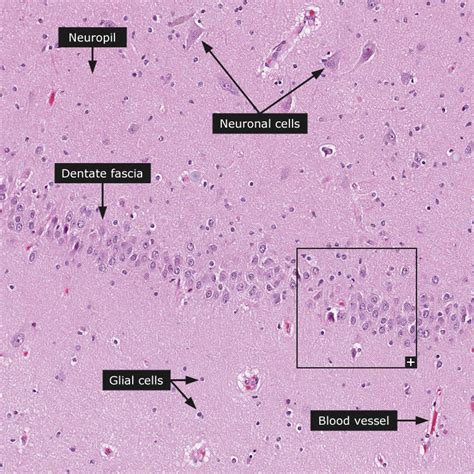 Access online via elsevier, 2006. Proteine Atlas Rat - Anti-MAPKAPK5 Antibody (HPA015515 ...