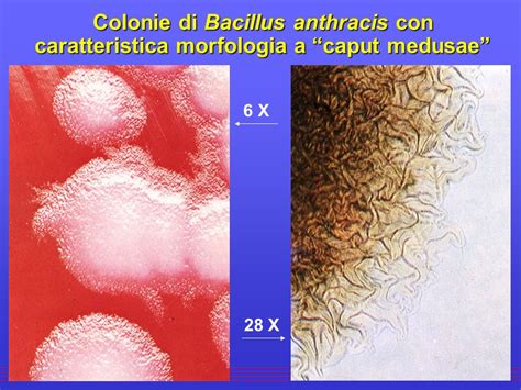 Bacillus Anthracis Scheda Batteriologica Ed Approfondimenti