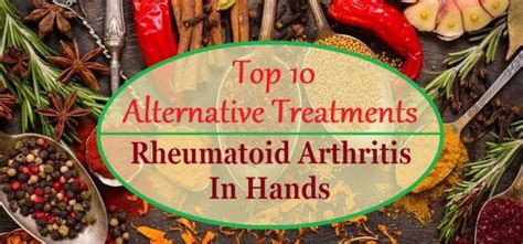 Top 10 Alternative Treatments For Rheumatoid Arthritis In Hands Cure