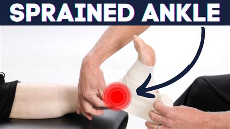 Sprained Ankle How To Wrap Ankle Sprains Correct Youtube