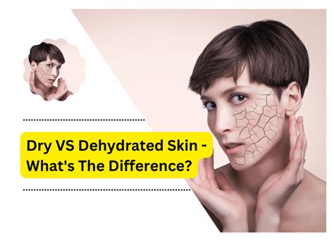 Dry Vs Dehydrated Skin Whats The Difference