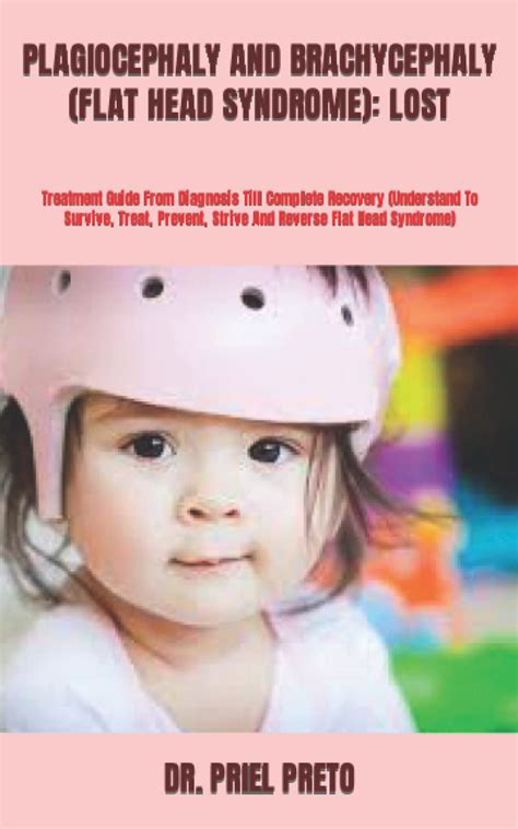 Buy Plagiocephaly And Brachycephaly Flat Head Syndrome Lost Guide