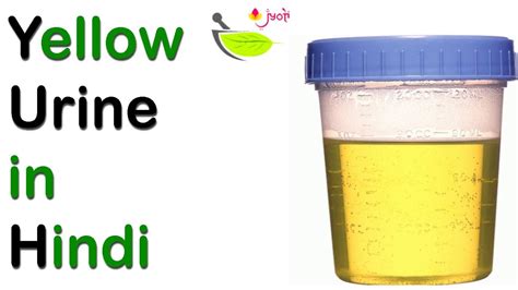 Is urine color an indicator of a disease? Yellow urine in hindi😨 - YouTube