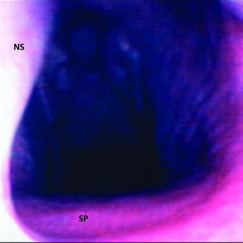 20. Endoscopic image of the nasopharynx of a horse with a cleft palate ...