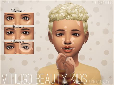 Sims 4 Vitiligo Beauty Skin Overlay Kids N3 The Sims Book