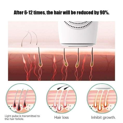 Deess Gp588 350000 Pulsed Ipl Hair Removal Device Laser Epilator