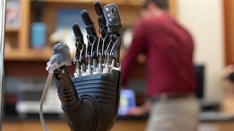 Electronic Skin Brings A Sense Of Touch To Prosthetics