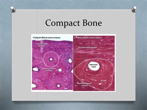 Ppt Histology Cartilage And Bone Powerpoint Presentation Free Download
