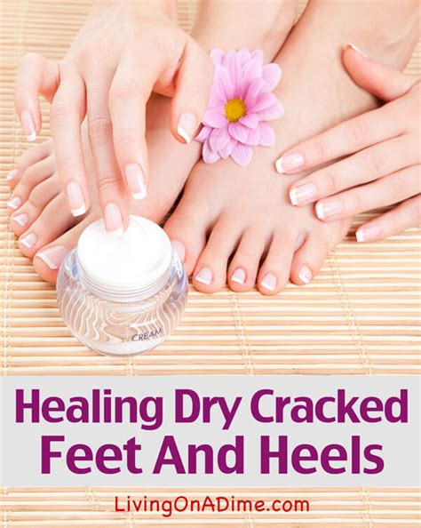 The Simple Solution Mom Healing Dry Feet And Cracked Heels