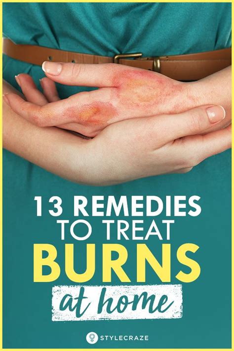 13 Remedies To Treat Burns At Home Burn Remedy Home Remedies For