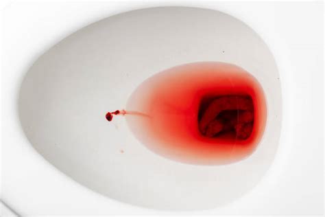 Blood In Sink Stock Photos Pictures And Royalty Free Images Istock